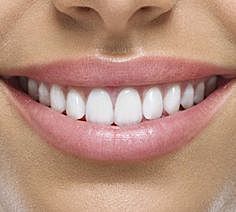 El día que em va caure la primera DENT