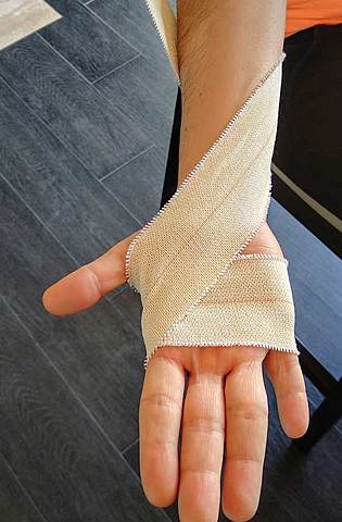 Esguince mano (basquetbol)