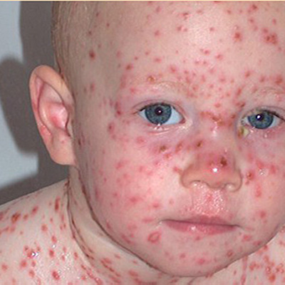 Timeline: 6 Pandemias que marcaron la historia