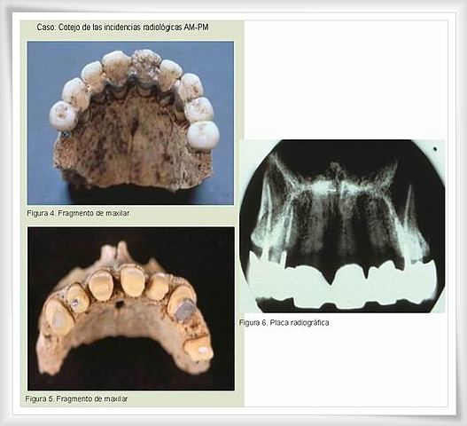 Sistema Dental/Rayos X