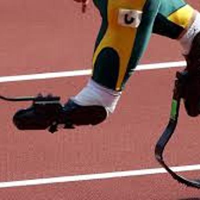 Timeline: Historia de las protesis