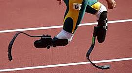 Timeline: Historia de las protesis