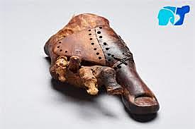 Comienzos  de las protesis