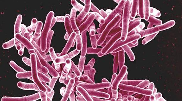Mycobacterium tuberculosis
