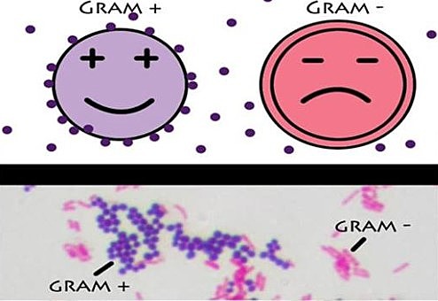 Desarrollo de la tinción de Gram