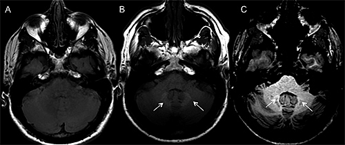 Estudio del cerebro por imágenes.