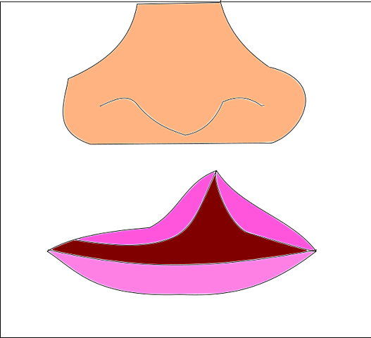 ¿Qué es el labio leporino?