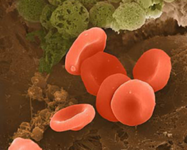 Enzimas que convierten cualquier tipo de sangre en O