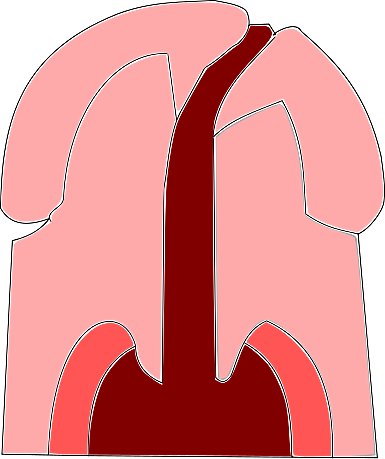 ¿Qué es lo que causa el labio leporino?