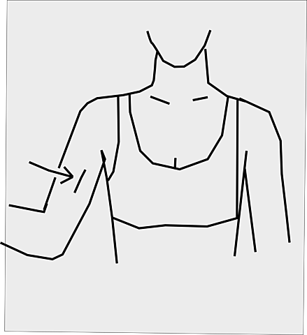 ANTICONCEPTIVO SUBDÉRMICO HORMONAL (IMPLANTE SUBCUTÁNEO) 99% DE EFECTIVIDAD.