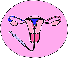 histerosalpingografia