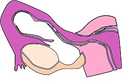 insuficiencia ovarica