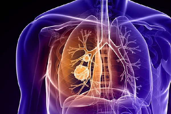 Gene responsável pela fibrose cística