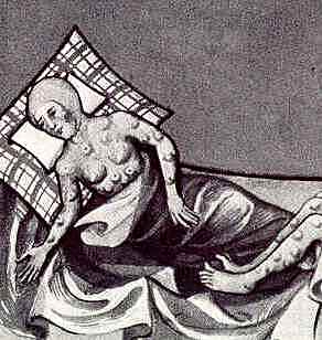 Peste Blanca o Tuberculosis