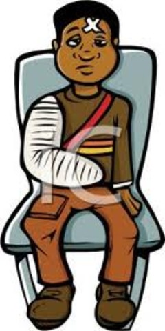 Broke my arm (right)