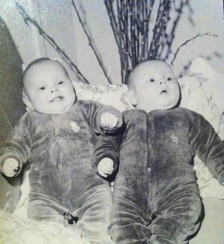 My mom was born with her twin sister