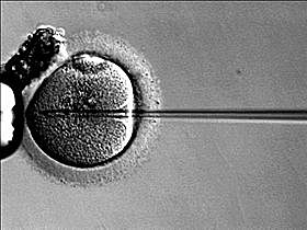 Intracytoplasmic sperm injection