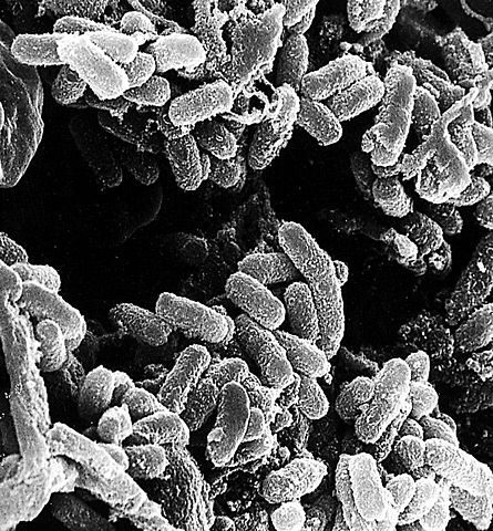 Discovery of the agent of the bubonic plague