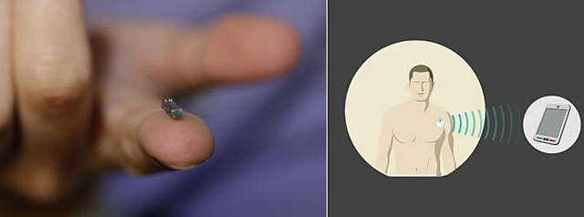 Wireless, implantable devices that monitor health conditions in real time.