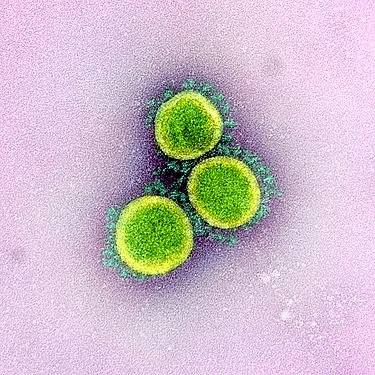 New SARS-CoV-2 virus causes a pandemic