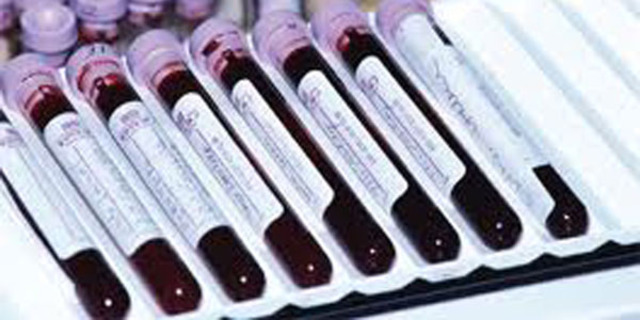 First trimester screen @ 11-13 weeks: