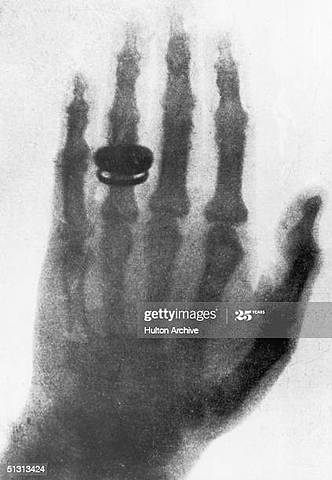 Wilhelm Conrad Röntgen