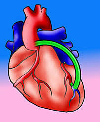 PROCEDIMENTO DE MI PADRE