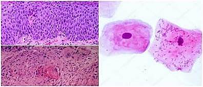 Las células epiteliales