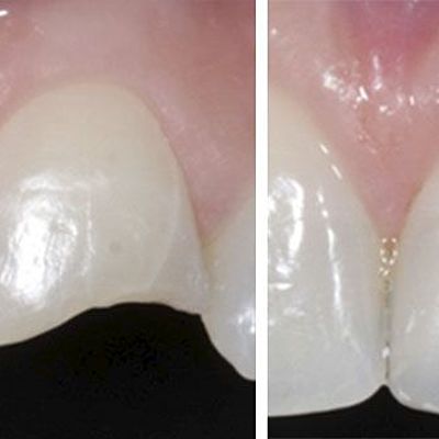 Timeline: PROCESO DE ADHESIÓN