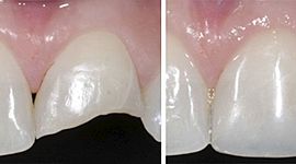 Timeline: PROCESO DE ADHESIÓN