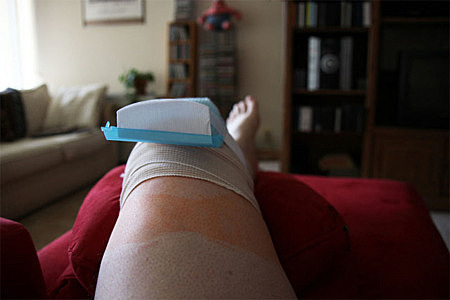 Lesión en mi rodilla