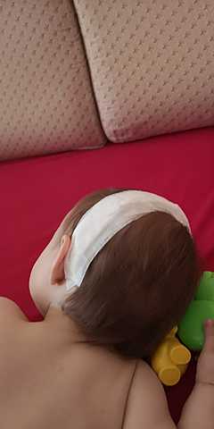 Acabada de la operació del meu germà petit