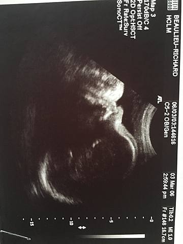 Naissance de Xavier, mon 2ème frère