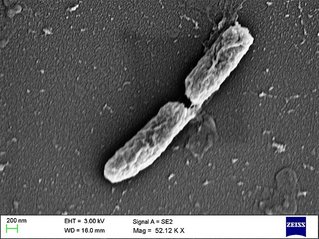 Shiga - Shigella dysenteriae