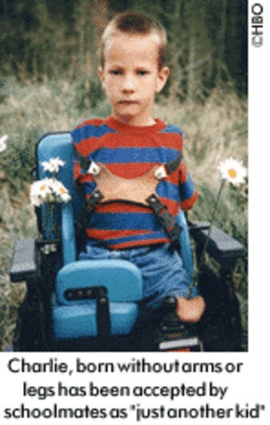 without Pity; a film about abilities