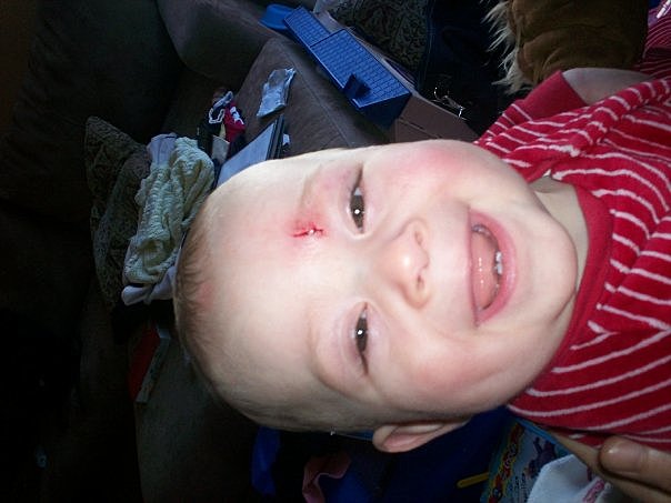 Ma première blessure de guerre