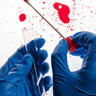 Timeline: Hematología forense