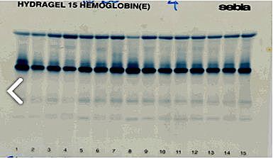Culliford y Benjamin Grunbaum