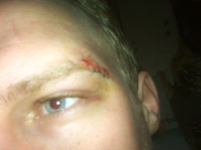 Hit Harrison in the head with a golf club