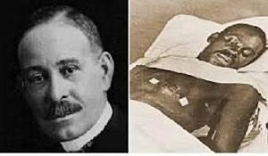 First Open Heart Surgery Performed by Black Physician, 1873