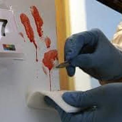 Timeline: Hematología Forense