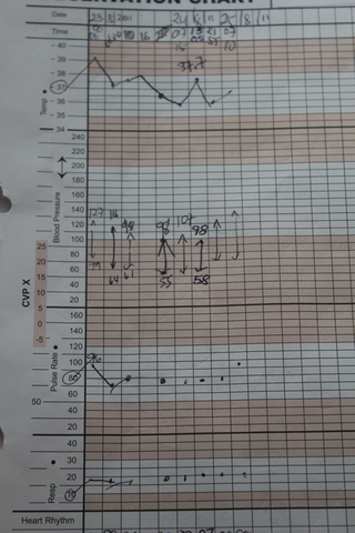 ~ 8:30am What Assessment Does MT Require?
