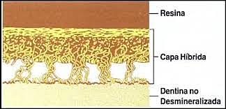 Nakabayashi "Capa Híbrida"