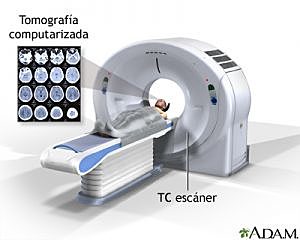 Avance de la neurotecnología