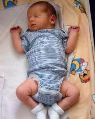 Hugo garcia was born