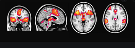 MORA Y SANGUINETTI (1996),