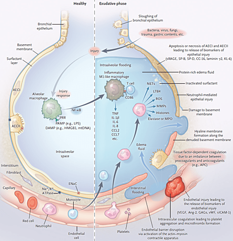 Diagnósticos de Enfermagem