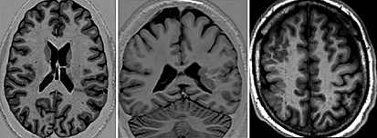 De 3 años en adelante.