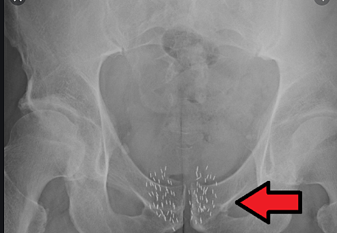 starting to apply in the medical field