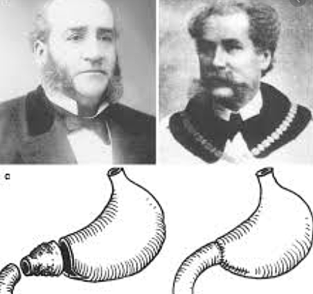 Gastric cancer treatment